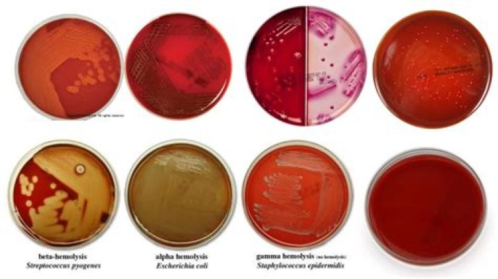 Can enterobacter cloacae be an esbl?