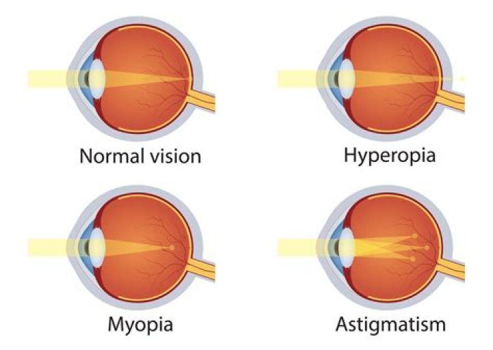 Can presbyopia lead to blindness?