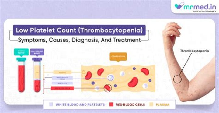 Do you have thrombocytopenia?
