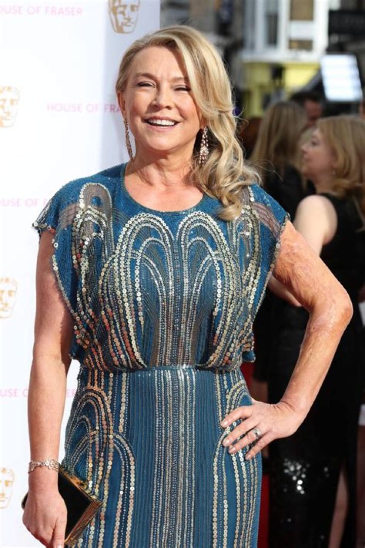 Does amanda redman have a scar on her arm?