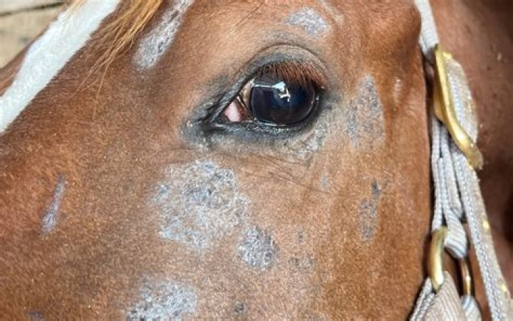 How to treat dermatomycoses?