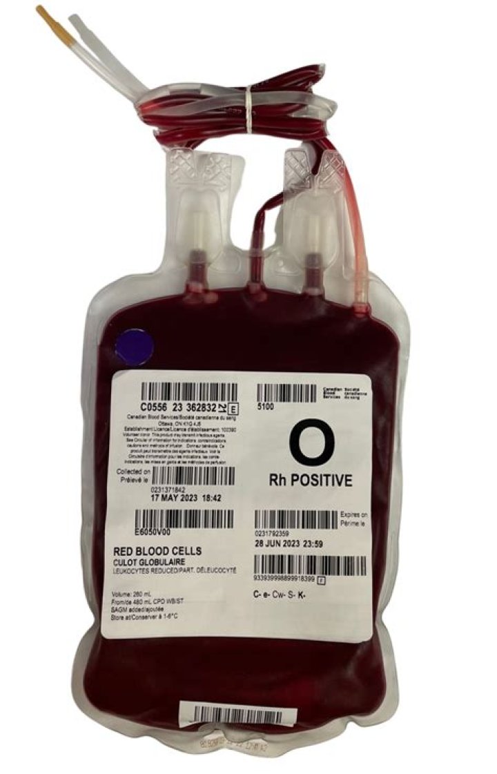Is 2 units of blood a lot?