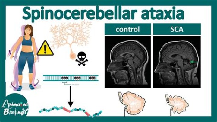 Is spinocerebellar ataxia a rare disease?