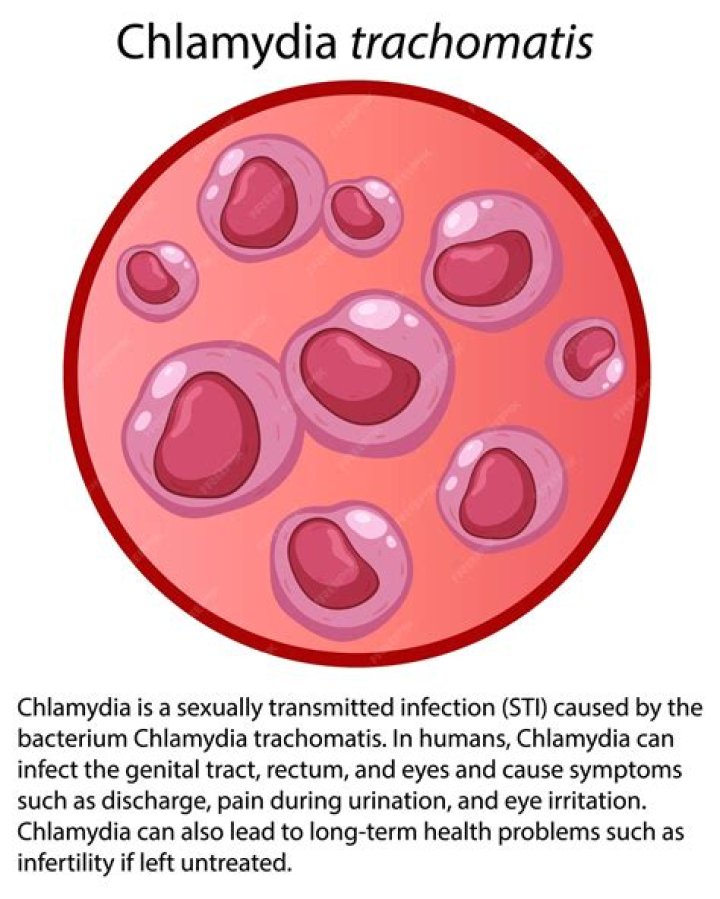 Why is chlamydia trachomatis test done?