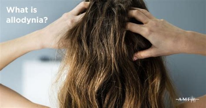 Why is my allodynia?
